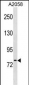 NLN Antibody (Center)